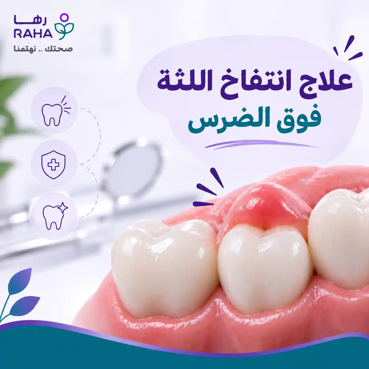 علاج انتفاخ اللثة فوق الضرس حسب السبب